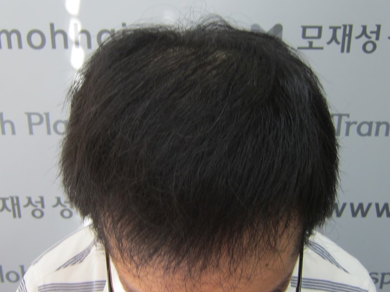 수술후.JPG