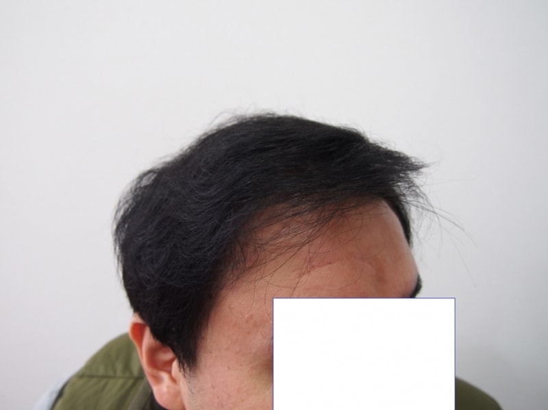 7개월3.JPG