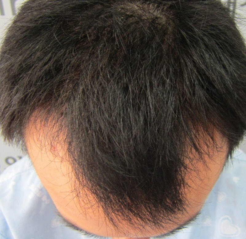 수술전1.JPG