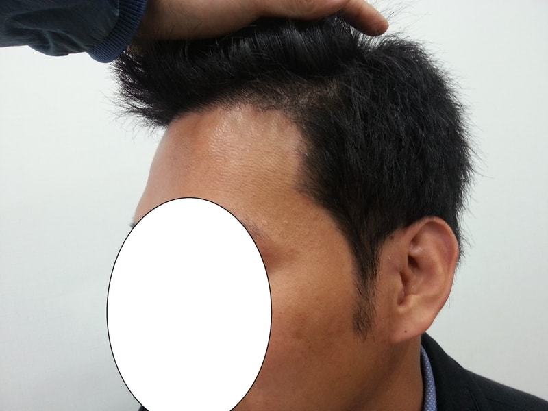 수술후2.jpg