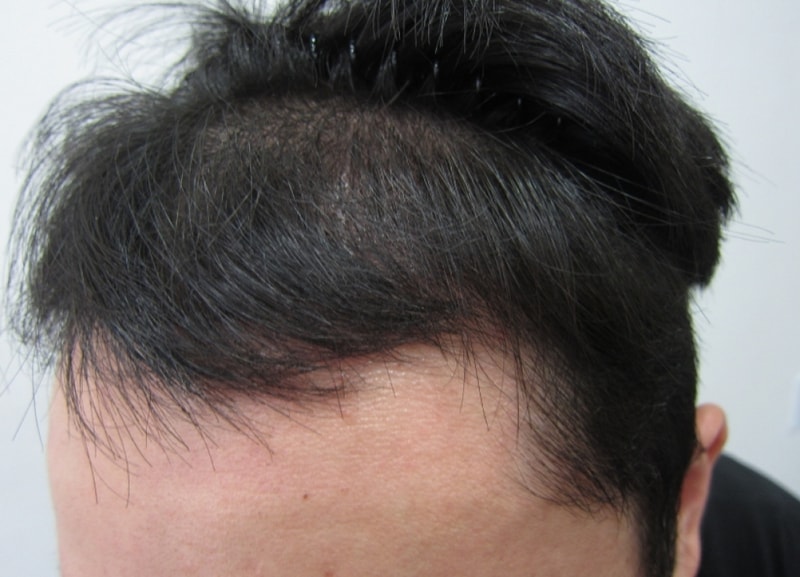 수술후2.JPG