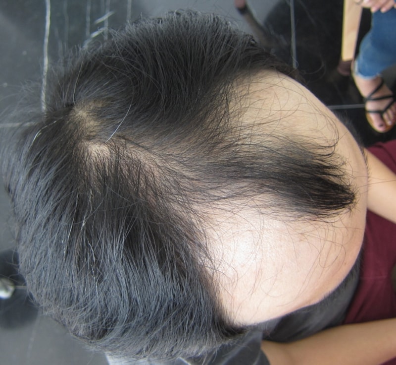 수술전1.JPG