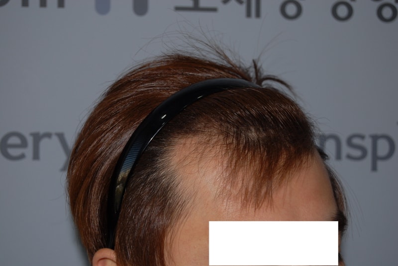 전2.JPG