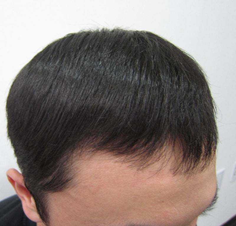 수술후3.JPG
