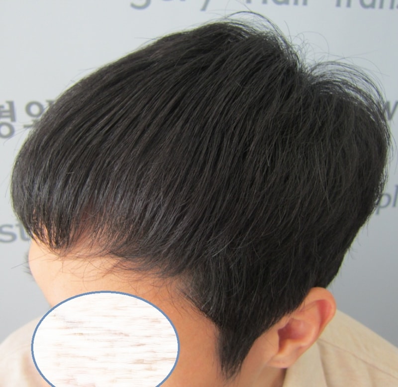 수술후3.JPG