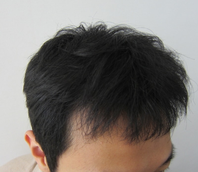 수술후4.JPG