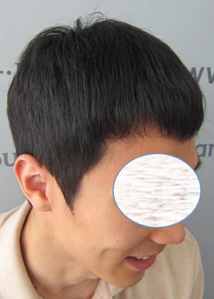 수술후2.JPG