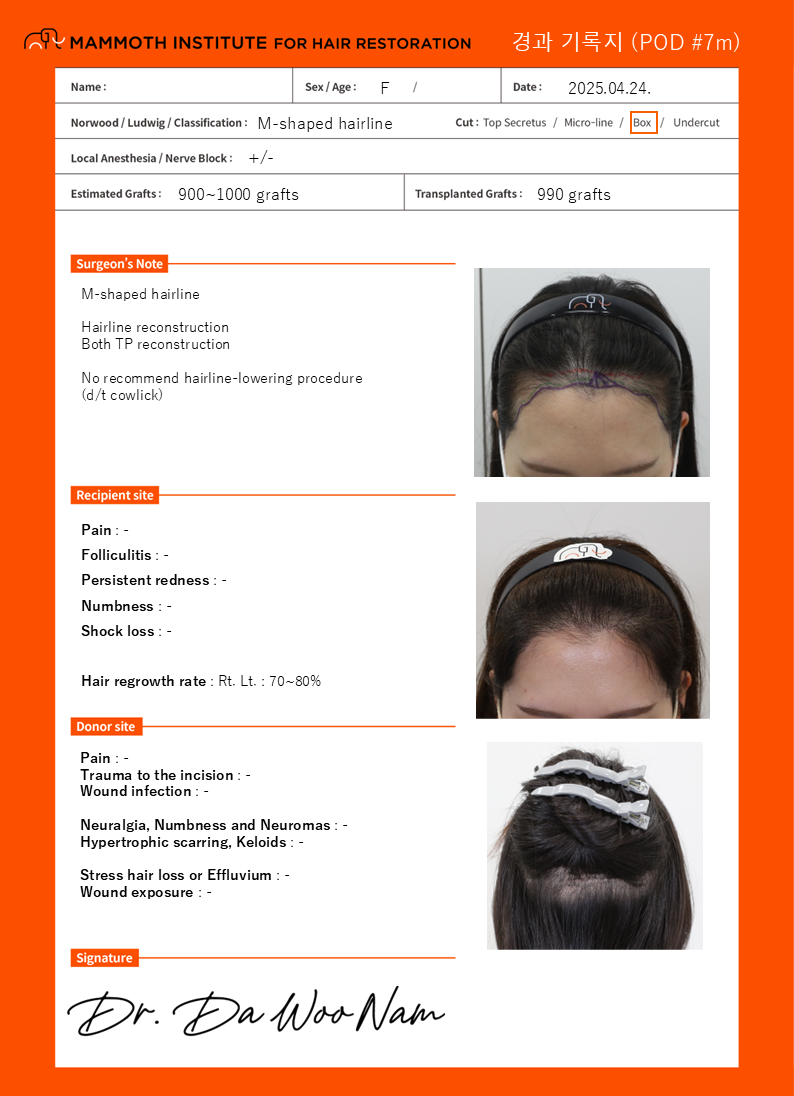 포토후기 이미지