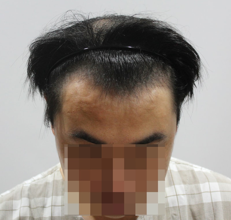 수술전 17.JPG