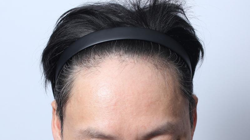 수술전 23.JPG