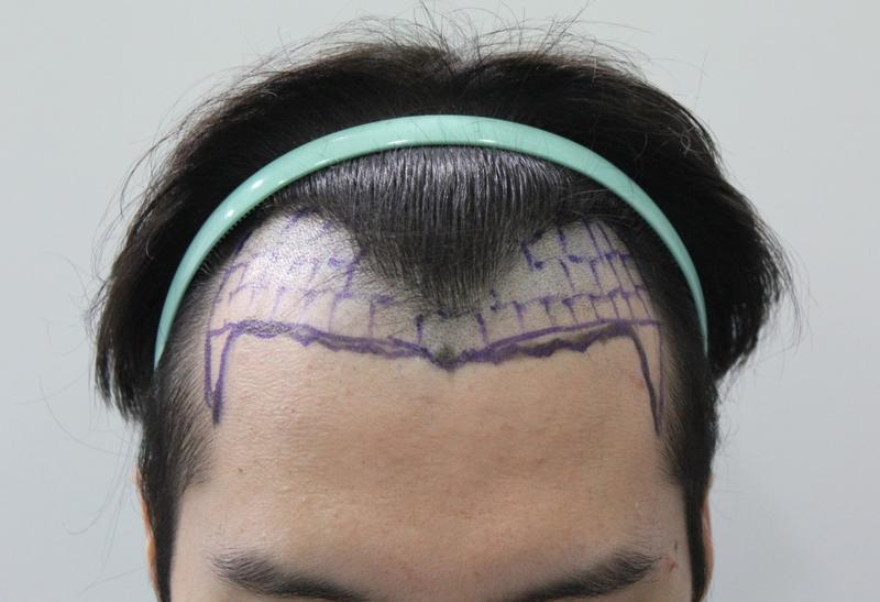 수술전_디자인_9.JPG