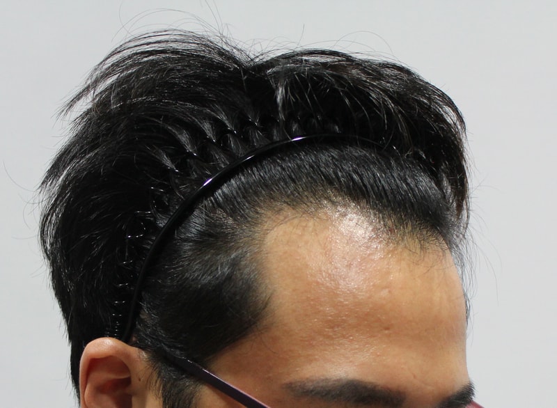 수술전 14.jpg