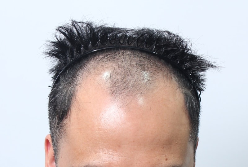 수술전 17.JPG