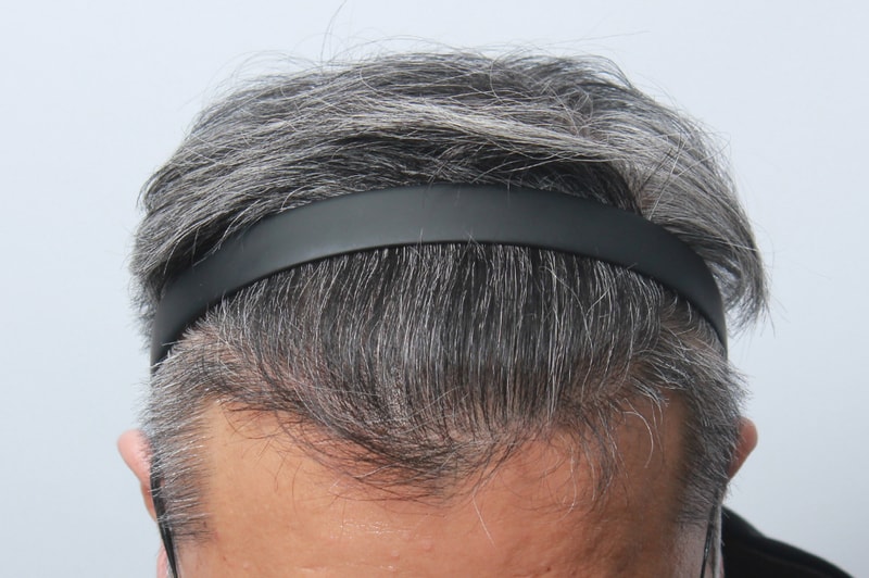 8달03.jpg