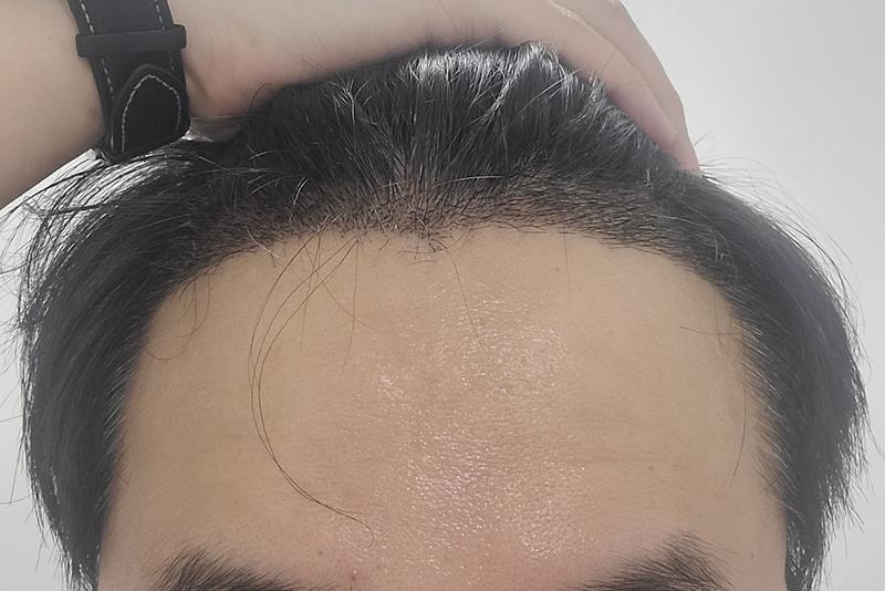 히든컷 약 7개월 후기