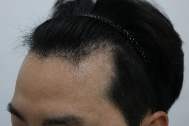 3400모 364일 지난 후기