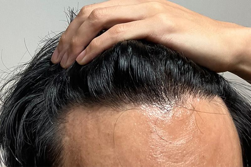 모먼트의원 3400모 1년 1개월 지남