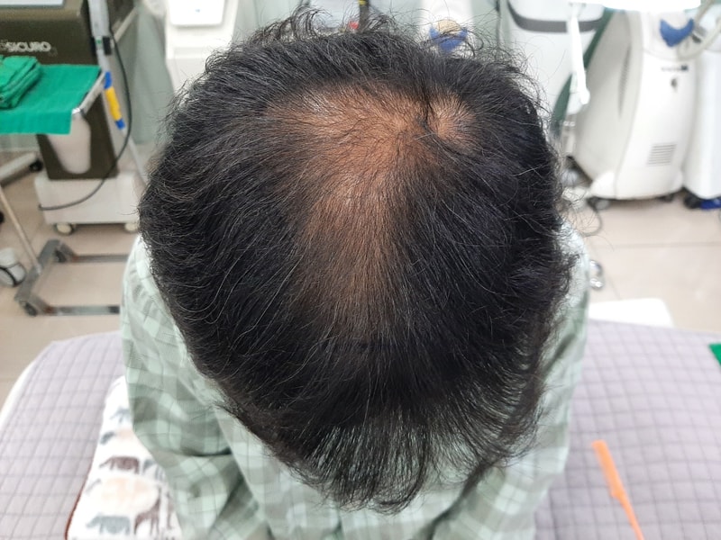 수술 전.jpg