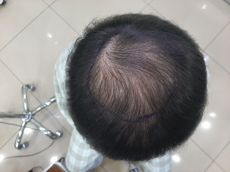 수술전.jpg