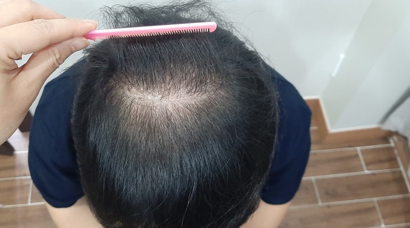 수술1Y3.jpg