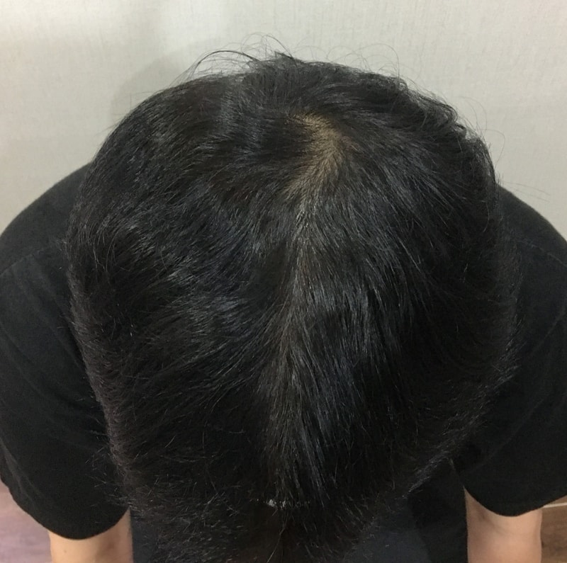3.이식 2Y4M 1.jpg