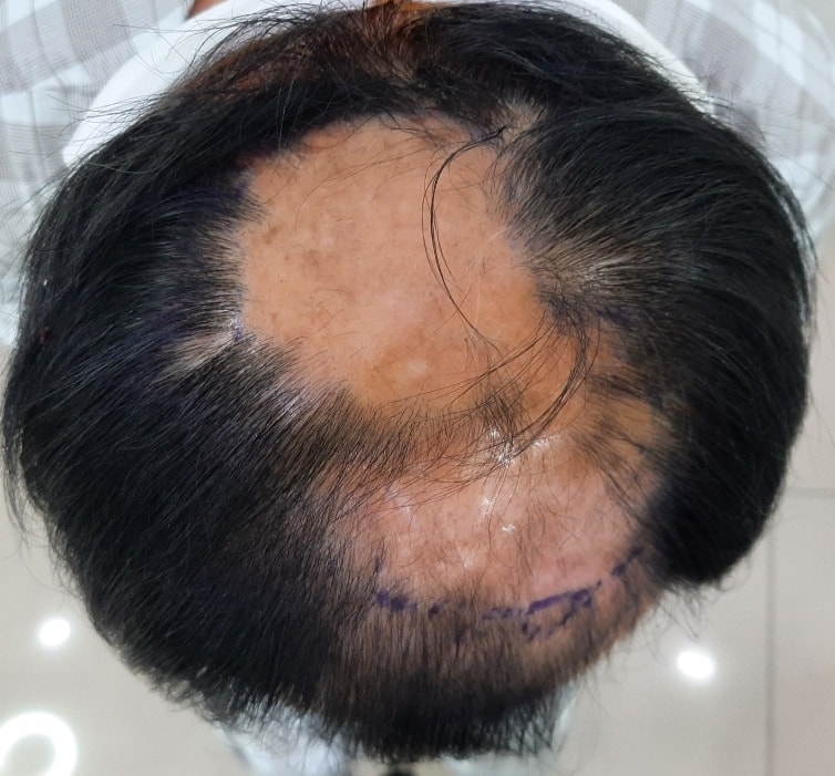 1.수술 전.jpg