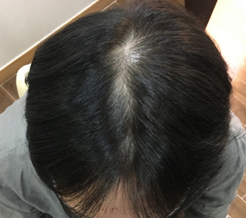 1.시술전1.jpg