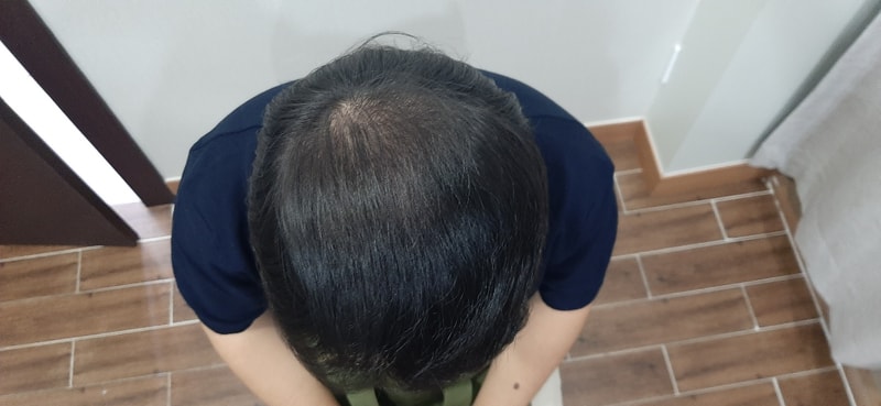 수술1Y.jpg