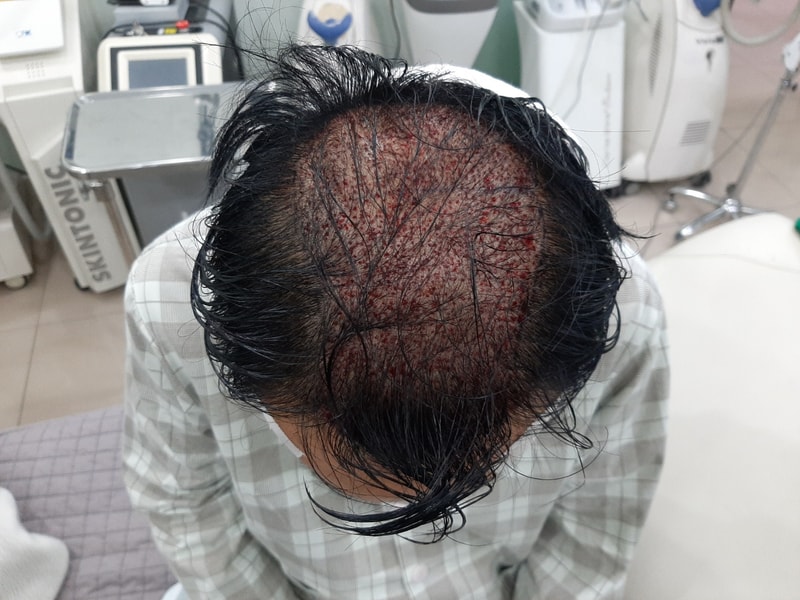 1.수술직후.jpg