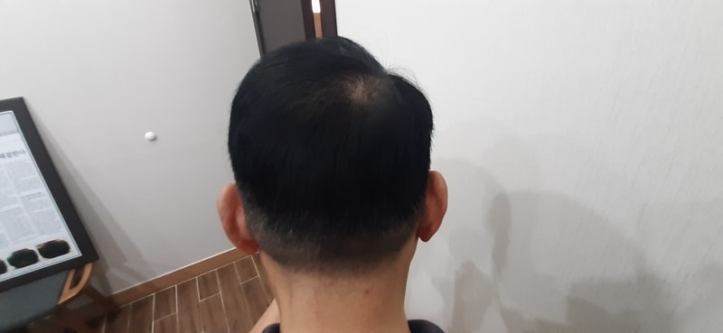 3. 수술 1Y8M1.jpg