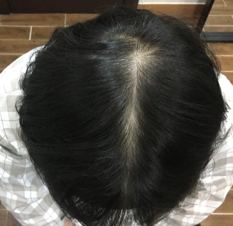 2.이식전1.jpg