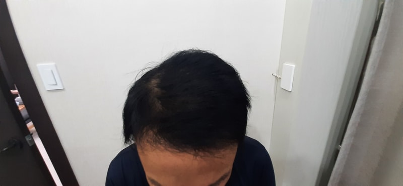 3. 수술 1Y8M3.jpg