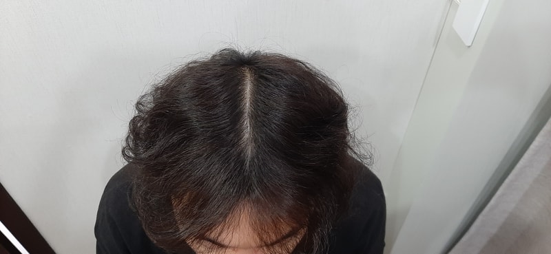 3.수술 1Y2.jpg