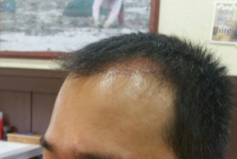KakaoTalk_20170804_161611448.jpg