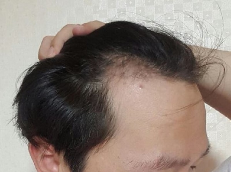 KakaoTalk_20180727_093917491.jpg
