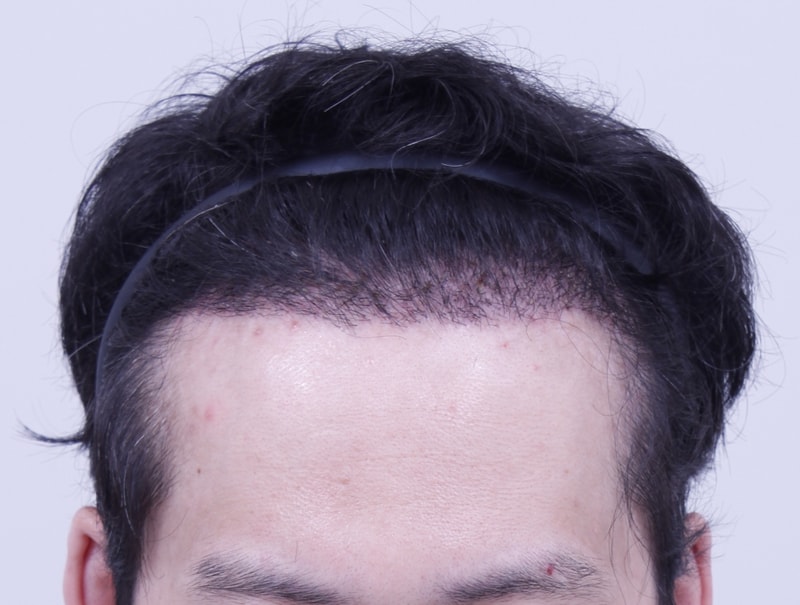 3주.JPG