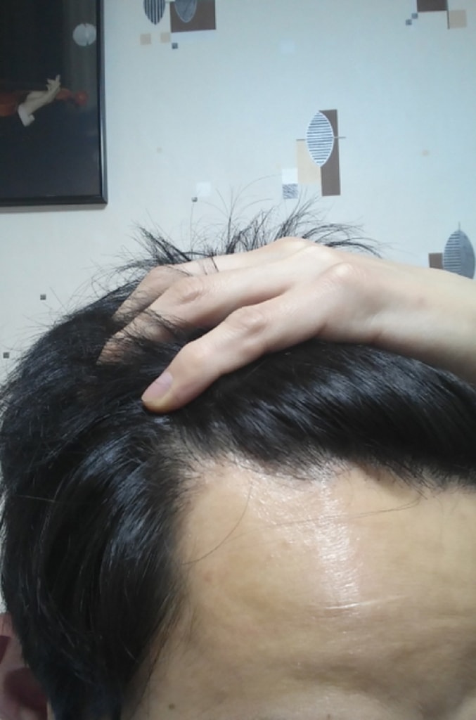 gf20150803_184135.jpg