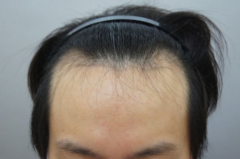 Change in progress up to 1 year