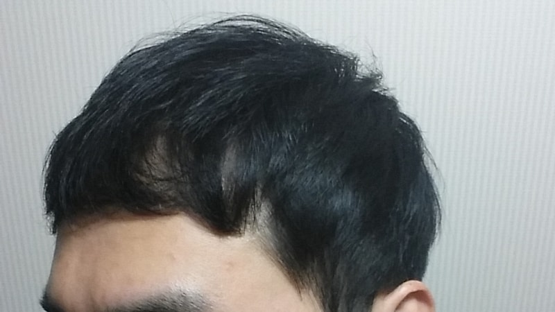 op20151221_130724.jpg