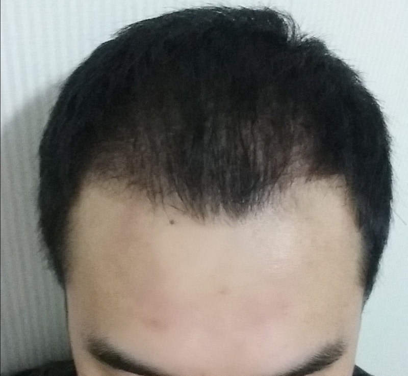 op20150624_180008.jpg