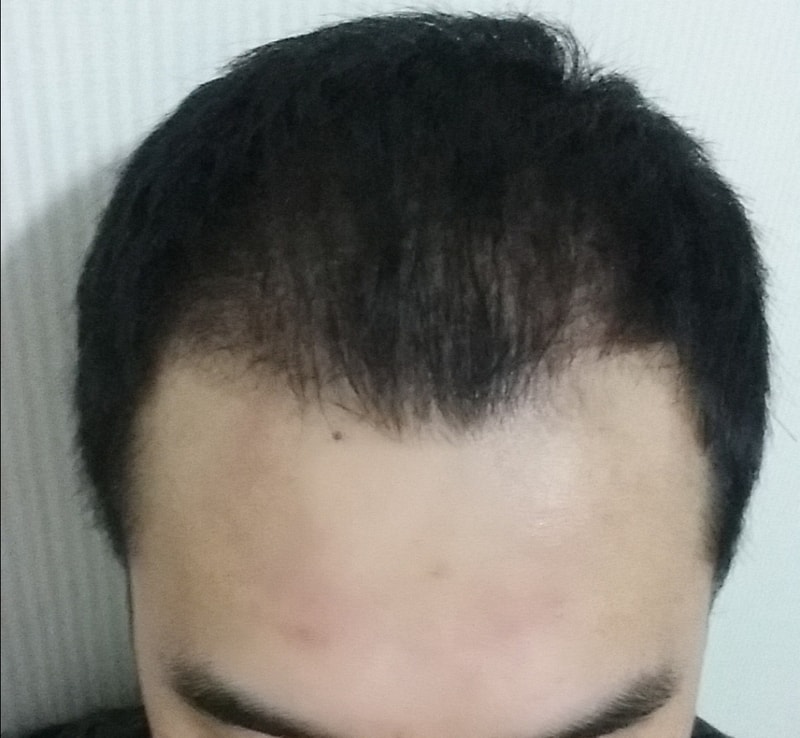 op20150624_180008.jpg