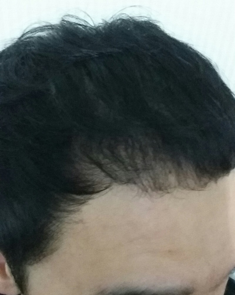 20150918_111820-1.jpg