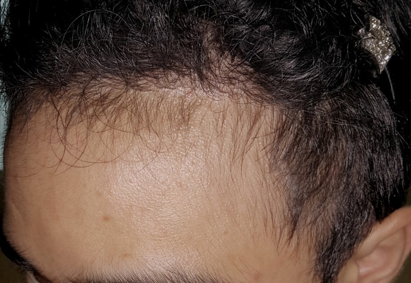 op20150723_172930.jpg