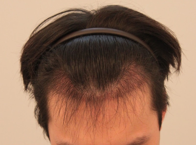 2.JPG