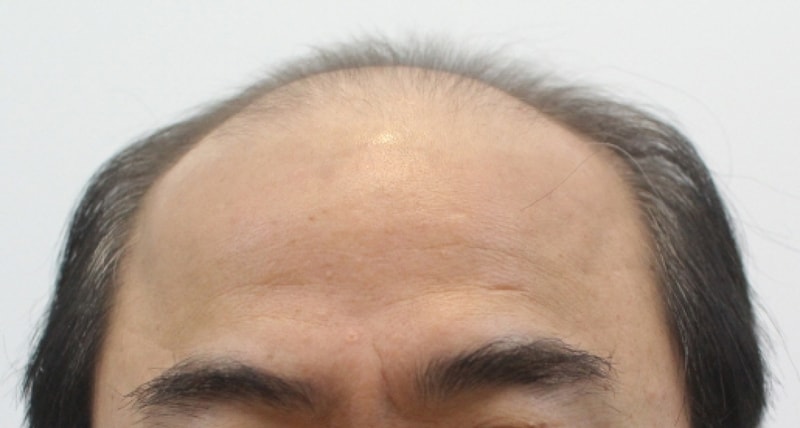 크기변환_포맷변환_수술전1.jpg