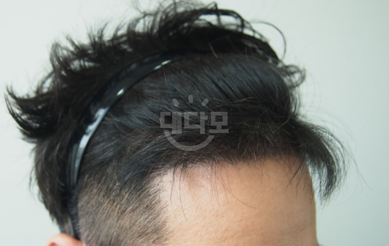 5개월 2.jpg