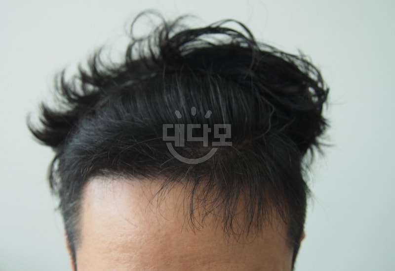 5개월 1.jpg