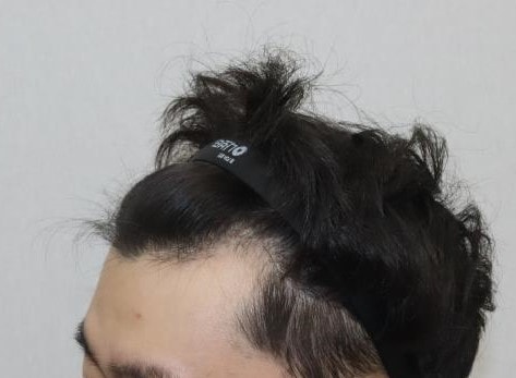수술 전 1ERHETBH.JPG
