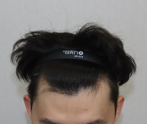 수술 전 2QETHETGBSDF.JPG