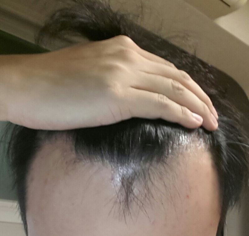 수술 전.jpg